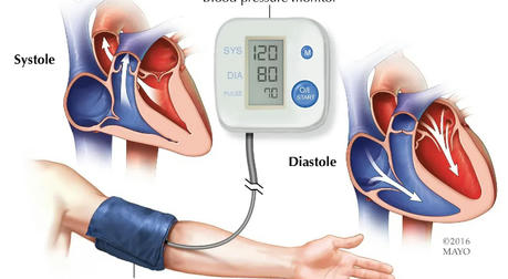 Understanding High Blood Pressure: A Comprehensive Guide to Risk Factors and Lifestyle Changes